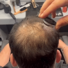 Polvo de relleno capilar ORVIAN™